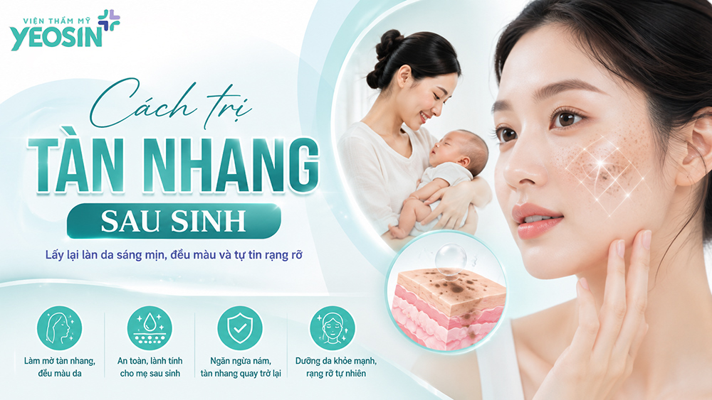 cách trị tàn nhang sau sinh hiệu quả