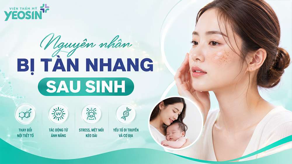 Nguyên nhân da bị tàn nhang sau sinh