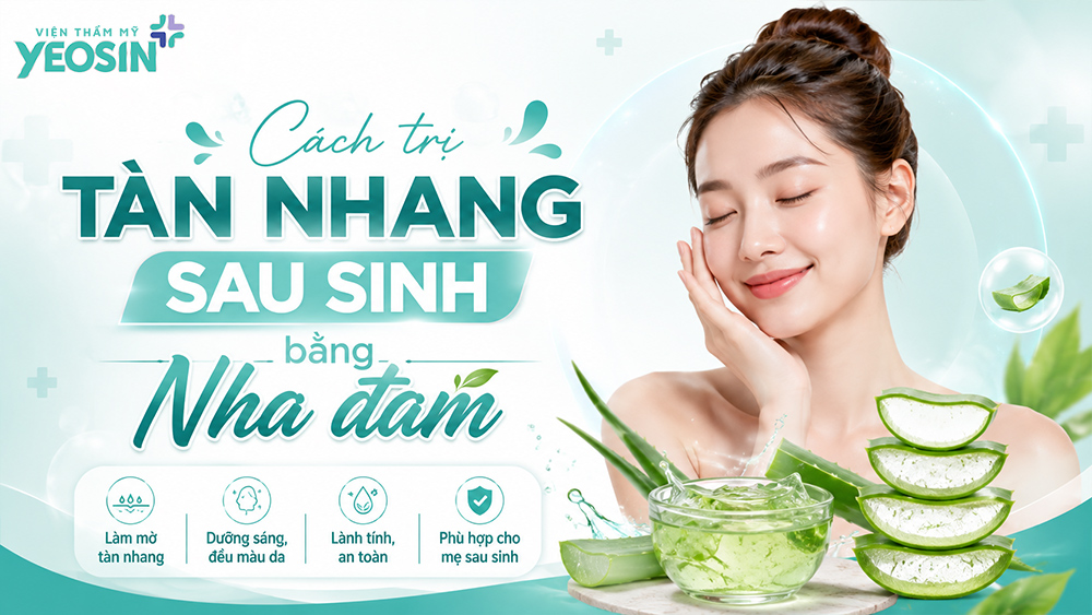 Cách trị tàn nhang sau sinh bằng nha đam