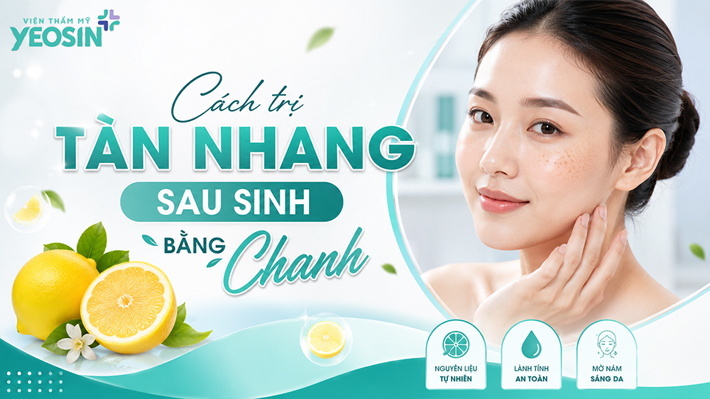 Cách trị tàn nhang sau sinh bằng chanh