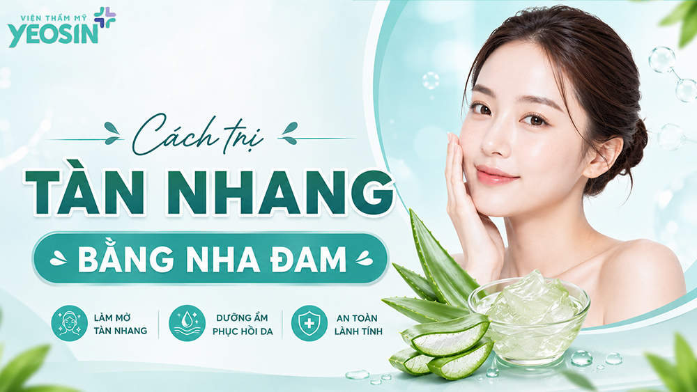 Top 7 cách trị tàn nhang tại nhà an toàn đơn giản 8 Cách chữa tàn nhang tại nhà bằng nha đam