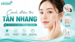 Tàn nhang là gì? Cách trị tàn nhang tận gốc