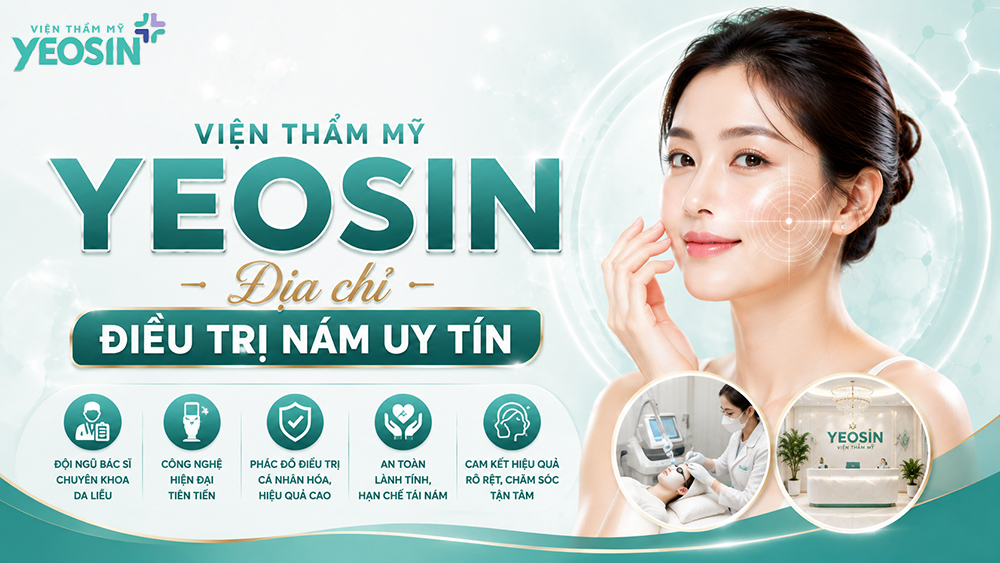 Chi phí điều trị nám - Bảng giá trị nám mới nhất hiện nay 8 Viện Thẩm Mỹ Yeosin – Địa chỉ điều trị nám uy tín