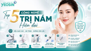 công nghệ trị nám hiệu quả