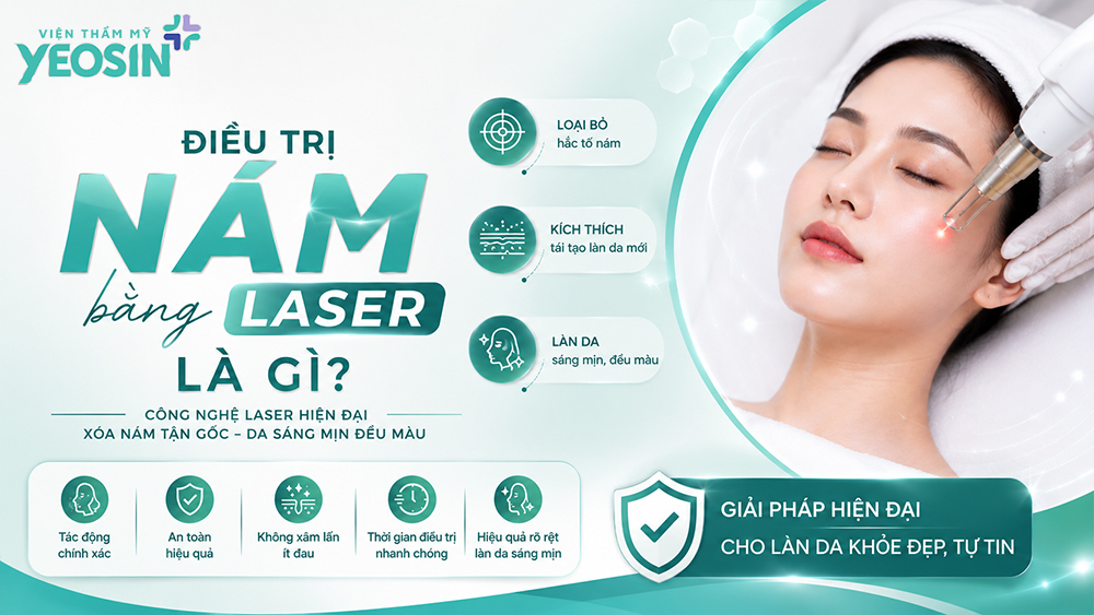 Điều trị nám bằng laser và những điều cần biết về laser nám 9 Điều trị nám bằng laser là gì?