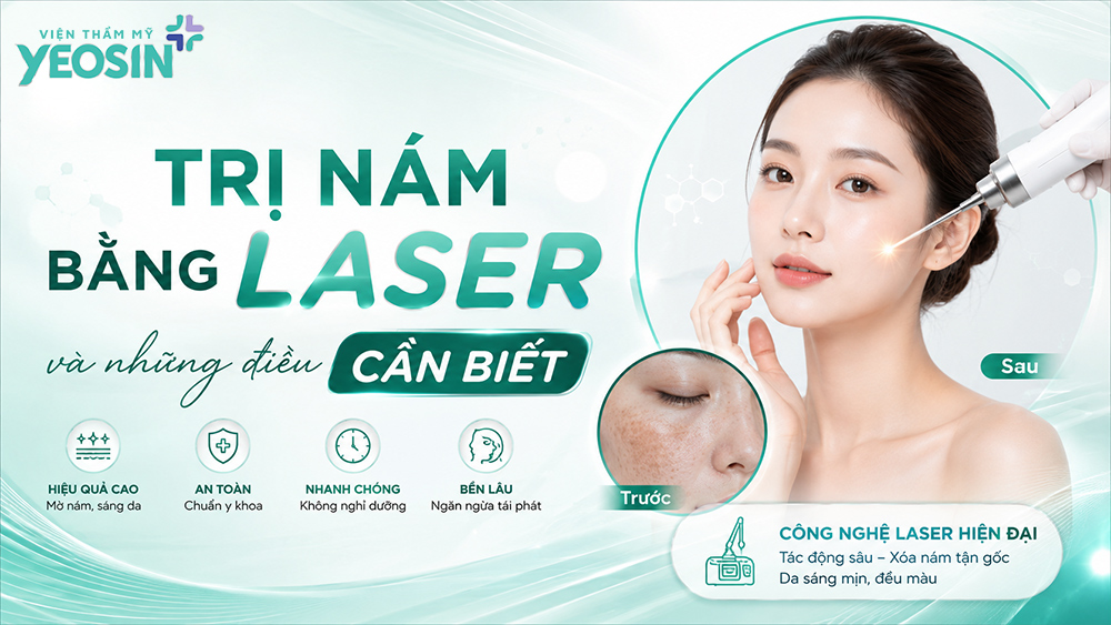 Điều trị nám bằng laser và những điều cần biết về laser nám