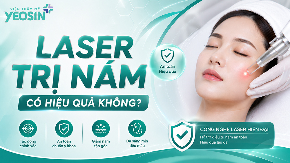 Điều trị nám bằng laser và những điều cần biết về laser nám 10 Laser trị nám có hiệu quả không?