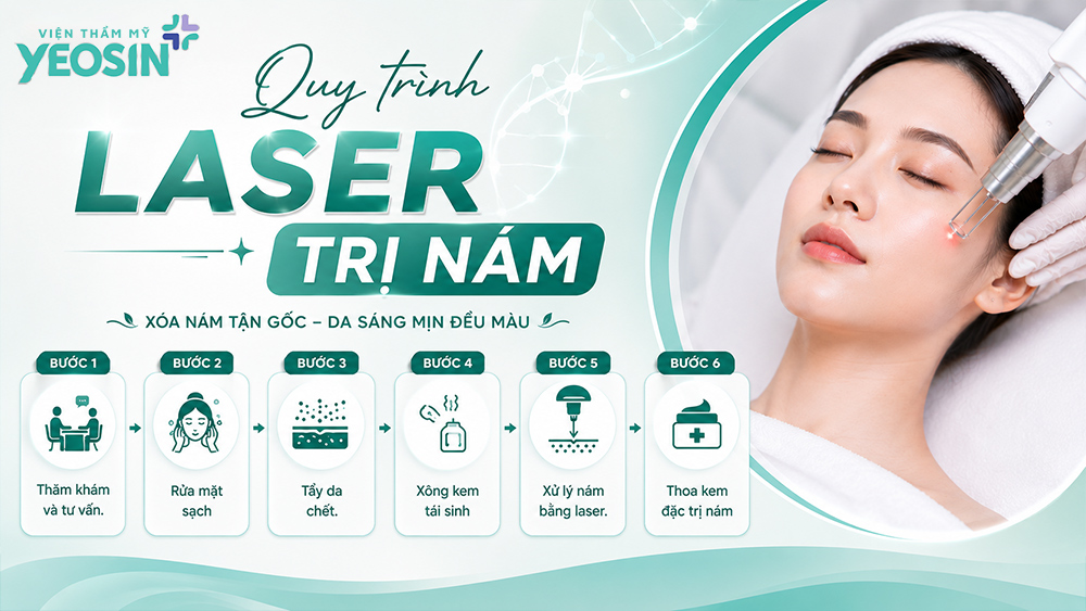 Điều trị nám bằng laser và những điều cần biết về laser nám 11 Quy trình điều trị nám bằng laser đúng chuẩn y khoa