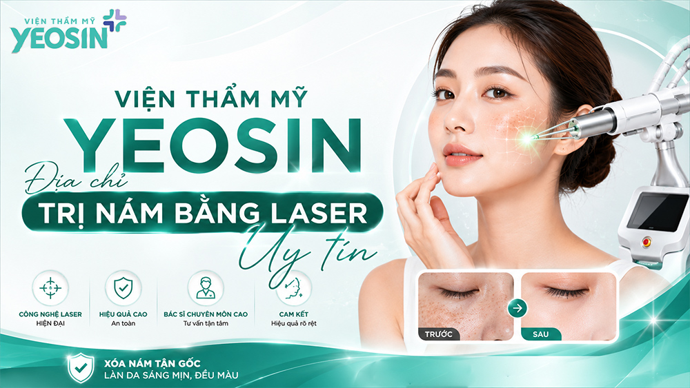 Điều trị nám bằng laser và những điều cần biết về laser nám 12 Vậy nên điều trị nám bằng laser ở đâu uy tín tại Tphcm?