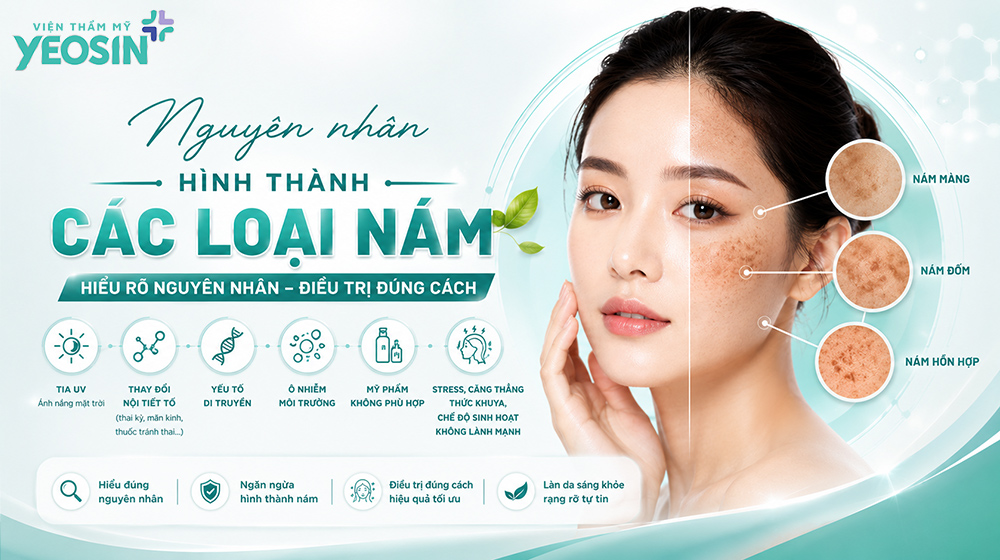 Da mặt bị nám - Tìm hiểu nguyên nhân gây nám da mặt. 8 Nguyên nhân hình thành các loại nám