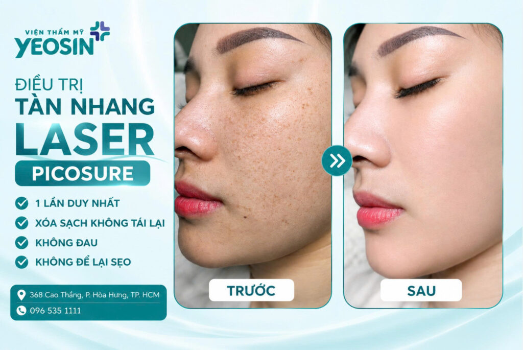 Chấm tàn nhang có hết không? Có để lại sẹo không? 16 Hình ảnh trước và sau khi trị tàn nhang tại Yeosin
