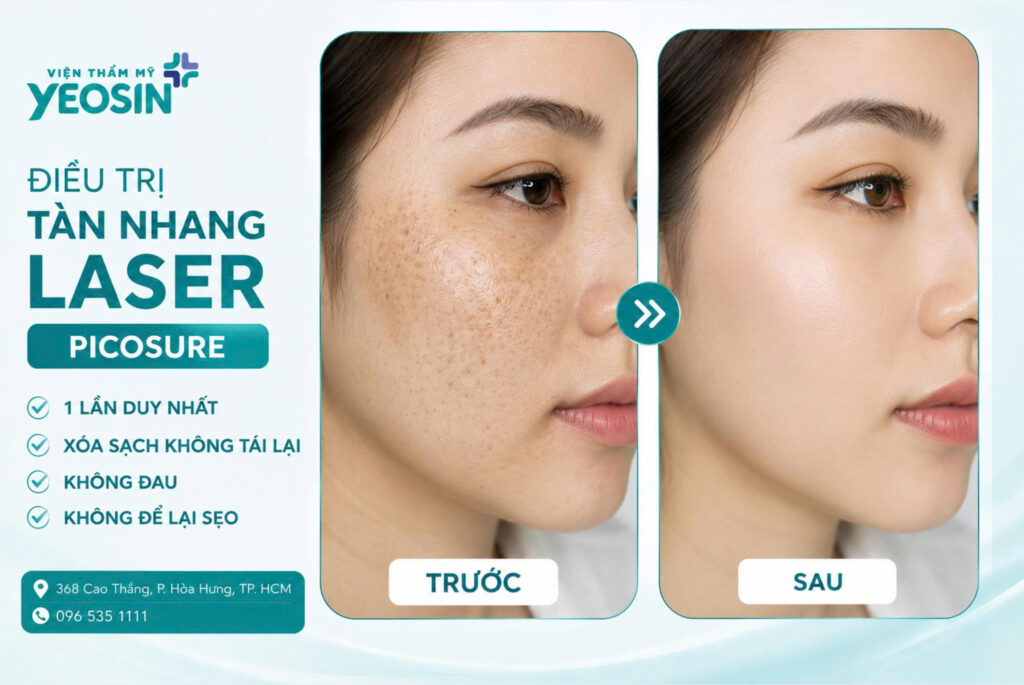 Chấm tàn nhang có hết không? Có để lại sẹo không? 15 Hình ảnh trước và sau khi trị tàn nhang tại Yeosin