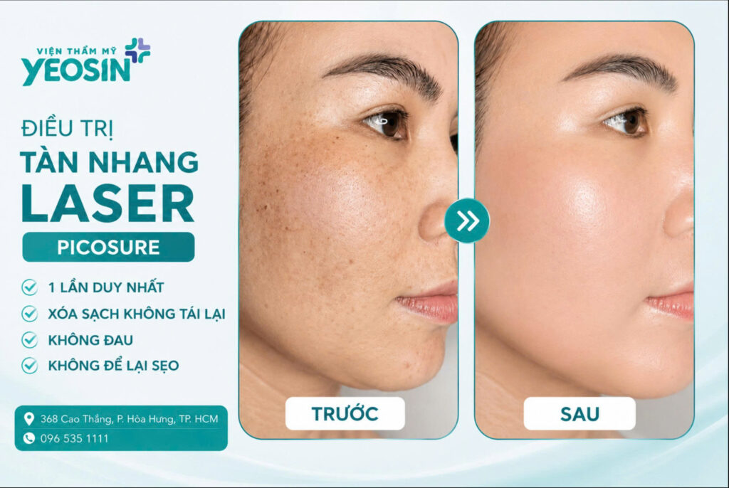 Chấm tàn nhang có hết không? Có để lại sẹo không? 14 Hình ảnh trước và sau khi trị tàn nhang tại Yeosin
