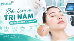 Bắn laser trị nám có hiệu quả không?