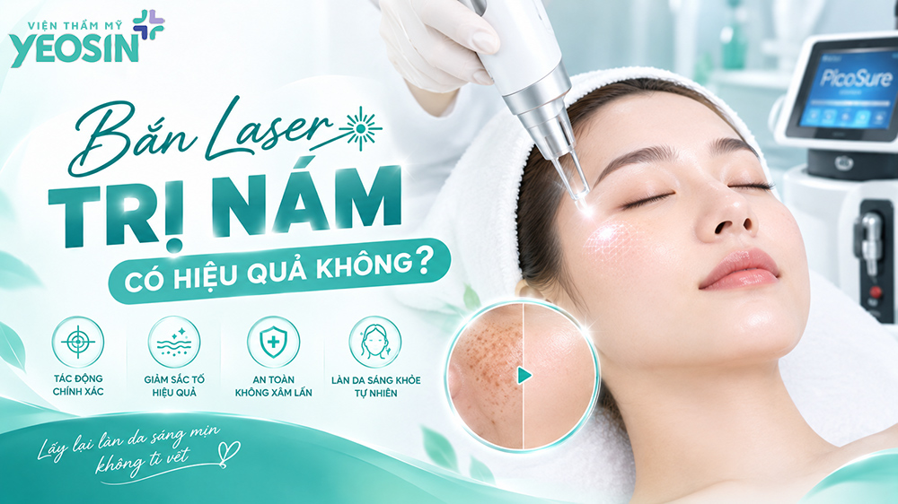 Bắn laser trị nám có hiệu quả không?