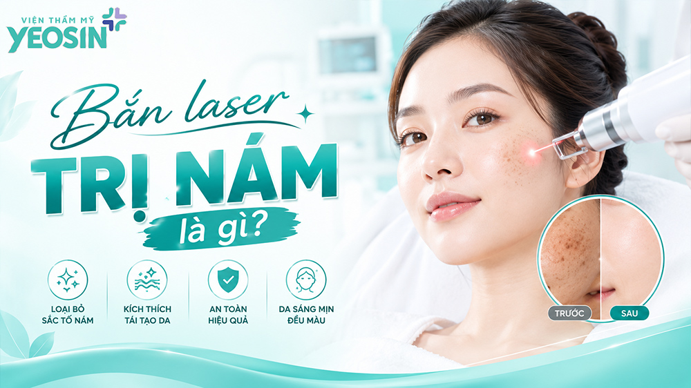 Bắn laser trị nám là gì?