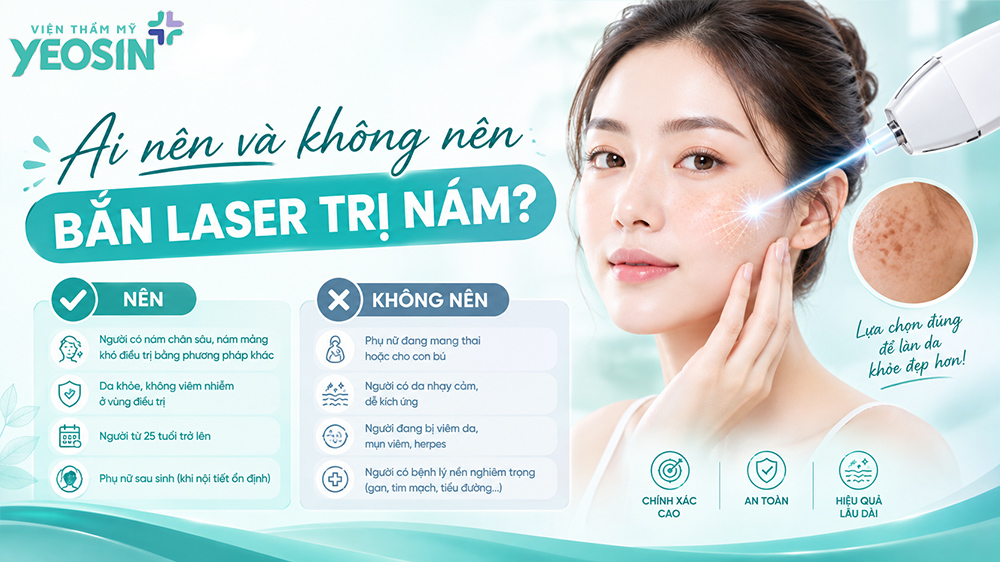 Ai nên và không nên bắn laser trị nám?