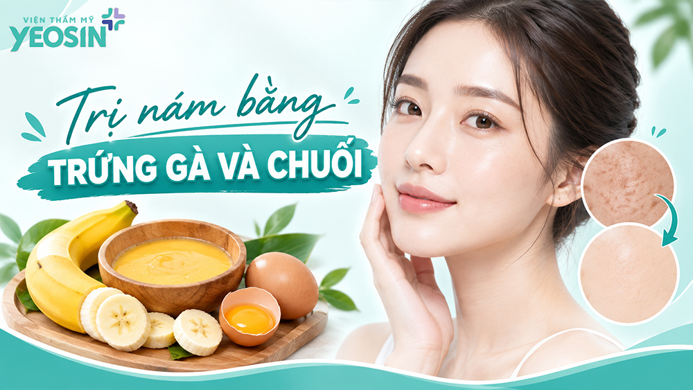 Cách trị nám bằng trứng gà và chuối