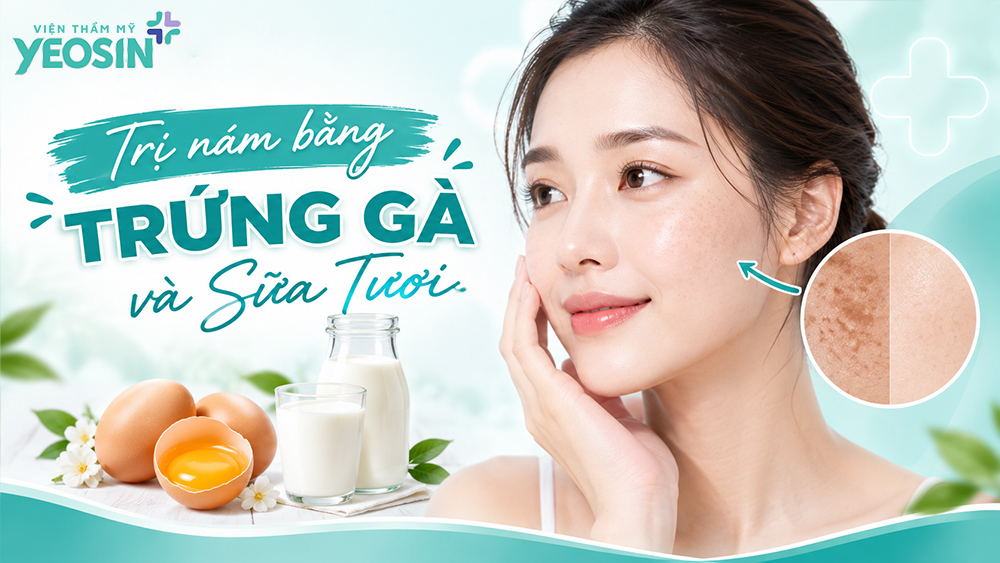 Cách trị nám bằng trứng gà và sữa tươi