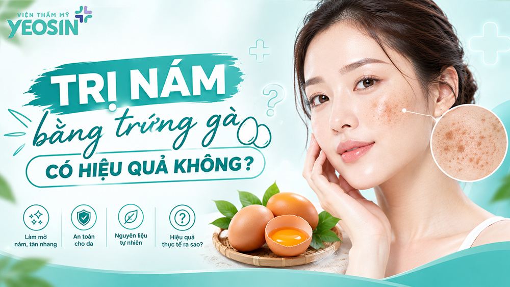Trị nám bằng trứng gà có hiệu quả không?