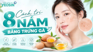 cách trị nám bằng trứng gà đơn giản tại nhà