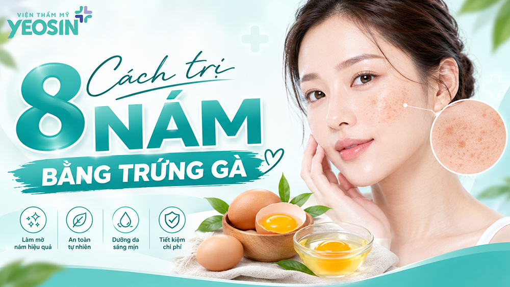 cách trị nám bằng trứng gà đơn giản tại nhà