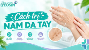Nám da tay