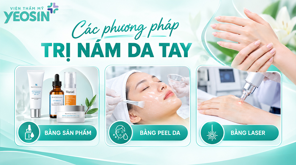 Nám da tay: Nguyên nhân và cách trị da tay bị nám 8 Các phương pháp trị nám da tay phổ biến
