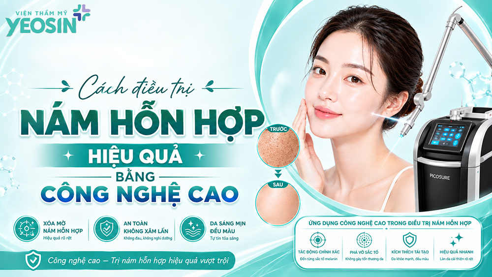 Nám hỗn hợp: Nguyên nhân và cách điều trị nám hỗn hợp 14 Cách điều trị da sạm nám bằng liệu trình công nghệ cao