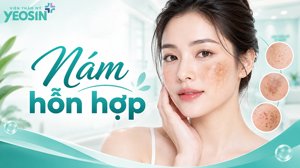 Nám hỗn hợp