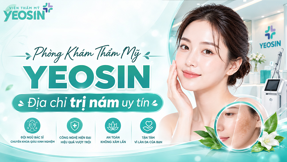 Nám hỗn hợp: Nguyên nhân và cách điều trị nám hỗn hợp 16 địa chỉ trị nám hỗn hợp uy tín tại Tphcm