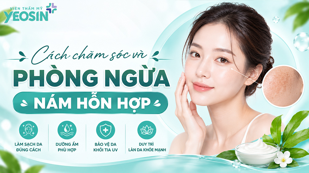 Nám hỗn hợp: Nguyên nhân và cách điều trị nám hỗn hợp 15 Cách chăm sóc và phòng ngừa nám hỗn hợp tái phát