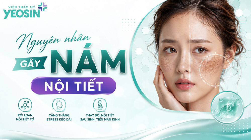 Nám nội tiết là gì? Nguyên nhân hình thành