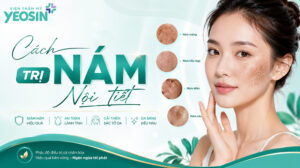 Nám nội tiết