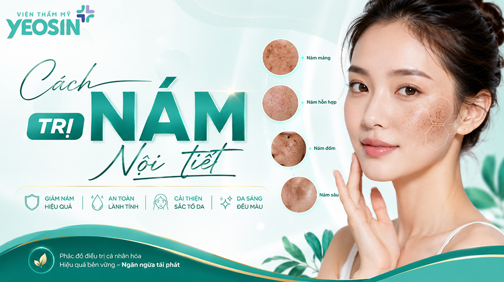 Nám nội tiết