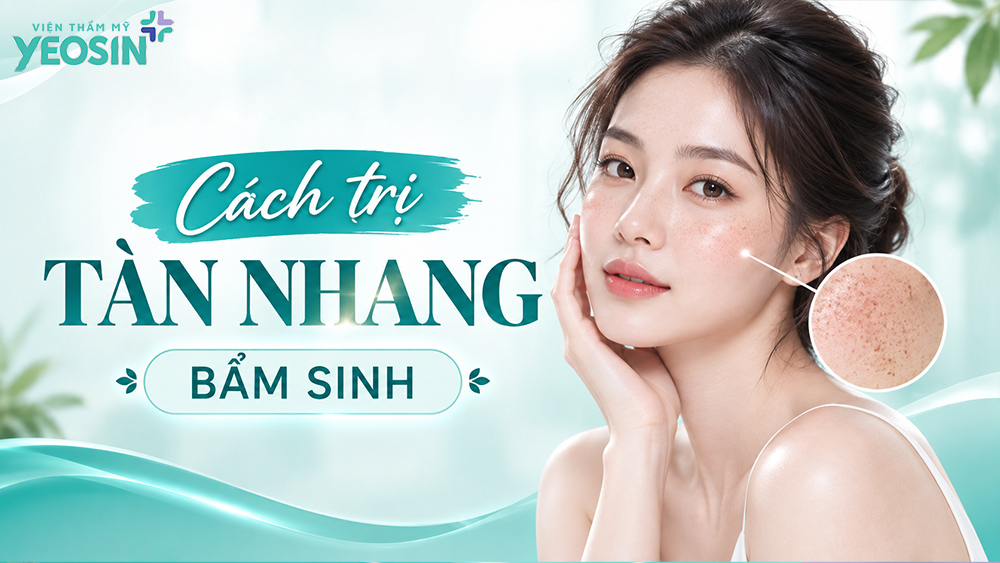 Tàn nhang bẩm sinh