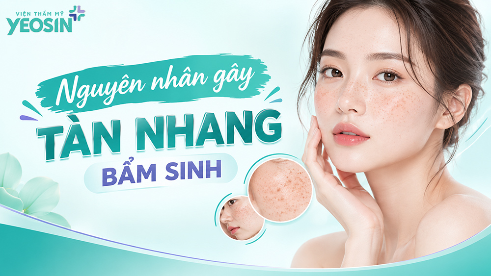 Tàn nhang bẩm sinh: Dấu hiệu, nguyên nhân và cách điều trị 9 Nguyên nhân gây tàn nhang bẩm sinh