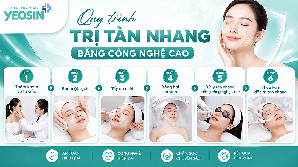 Tàn nhang bẩm sinh: Dấu hiệu, nguyên nhân và cách điều trị 12 Quy trình điều trị tàn nhang bằng công nghệ cao