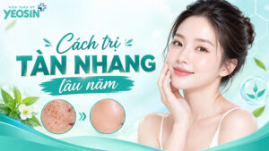 cách trị tàn nhang lâu năm hiệu quả