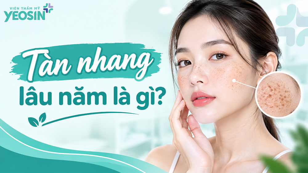 Tàn nhang lâu năm là gì?