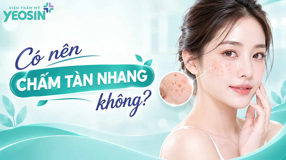 Có nên chấm tàn nhang không?
