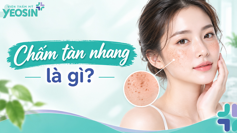 Chấm tàn nhang là gì? Chấm tàn nhang là gì?