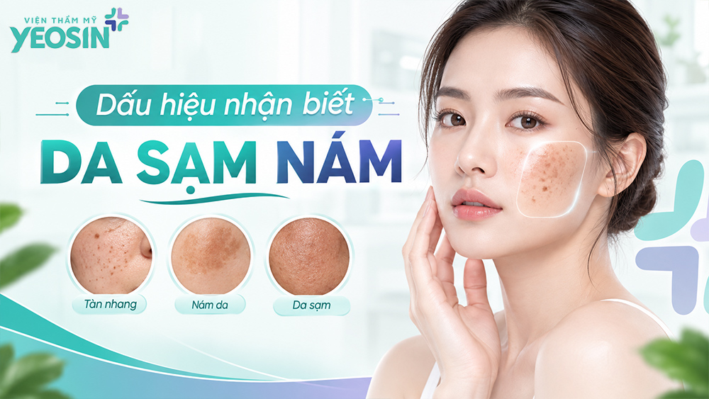Da sạm nám là gì? Nguyên nhân, dấu hiệu và cách điều trị 9 Da sạm nám là gì? Dấu hiệu nhận biết