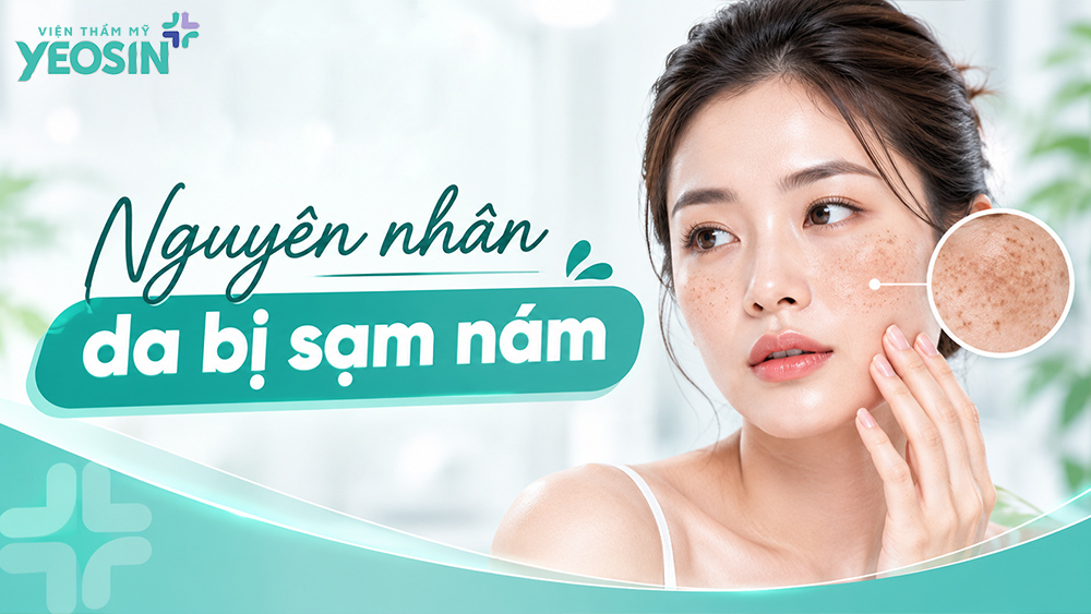 Da sạm nám là gì? Nguyên nhân, dấu hiệu và cách điều trị 10 Nguyên nhân gây tình trạng da sạm nám