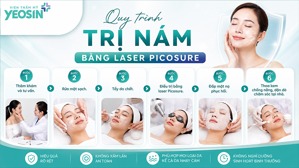 Hình ảnh nám da mặt: Nhận biết và hình ảnh trước sau khi trị nám 15 Hình ảnh các bước trị nám da mặt bằng laser