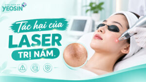 Tác hại của việc trị nám bằng laser là gì?