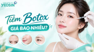 Tiêm botox giá bao nhiêu tiền?