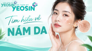 Nám da: Dấu hiệu, nguyên nhân và cách điều trị nám da