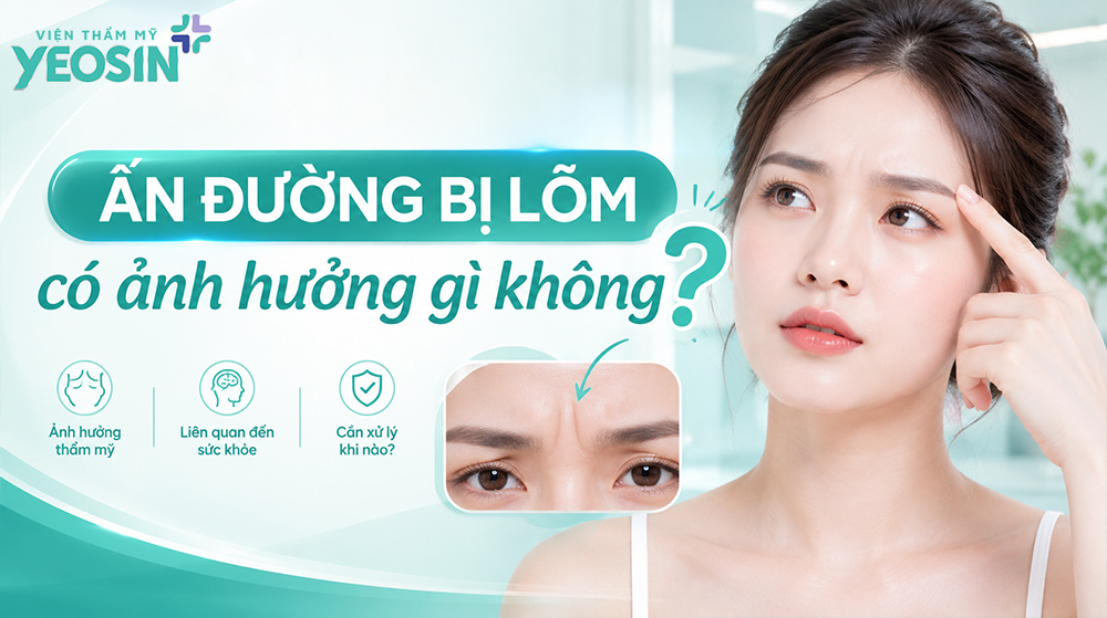 Ấn đường bị lõm là gì? Cách khắc phục ấn đường lõm sâu 12 Ấn đường bị lõm có ảnh hưởng gì không?