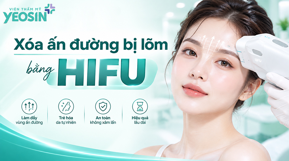 Ấn đường bị lõm là gì? Cách khắc phục ấn đường lõm sâu 15 Xóa nhăn ấn đường bị lõm bằng công nghệ Hifu